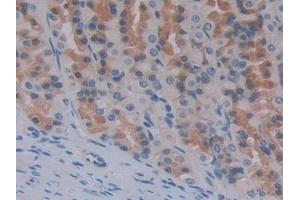 Detection of ENPEP in Rat Stomach Tissue using Polyclonal Antibody to Aminopeptidase A (ENPEP) (ENPEP 抗体  (AA 409-624))