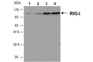 Western blot analysis of human RIG-I in HeLa cells by using RIG-I, mAb (Alme-1) . (DDX58 抗体  (AA 201-713))