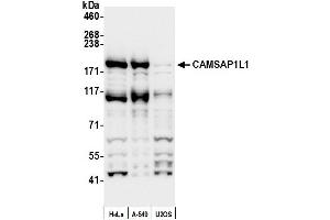 anti-Calmodulin Regulated Spectrin-associated Protein 1-like 1 (CAMSAP1L1) (AA 375-425) antibody