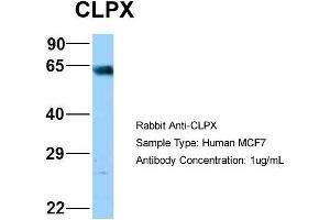 Host: Rabbit Target Name: NOP56 Sample Type: MCF7 Antibody Dilution: 1. (CLPX 抗体  (C-Term))