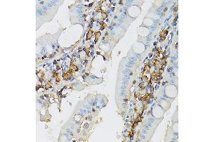 Immunohistochemistry (IHC) image for anti-Mast/stem Cell Growth Factor Receptor (KIT) (AA 25-295) antibody (ABIN6142896)