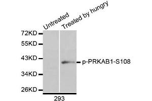Western blot analysis of extracts of 293 cells, using Phospho-AMPKβ1-S108 antibody (ABIN5995625) at 1/1000 dilution.
