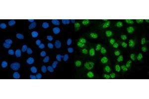 IF analysis of DMAP1 using anti-DMAP1 antibody (ABIN7601999). (DMAP1 抗体  (AA 54-401))