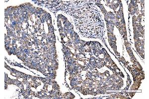 IHC analysis of SOD2 using anti-SOD2 antibody (ABIN7602799). (SOD2 抗体  (C-Term))