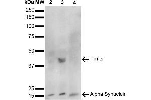Western Blot analysis of Human, Mouse, Rat Brain showing detection of 14 kDa Alpha Synuclein protein using Mouse Anti-Alpha Synuclein Monoclonal Antibody, Clone 10H7 (ABIN5564083). (SNCA 抗体  (FITC))