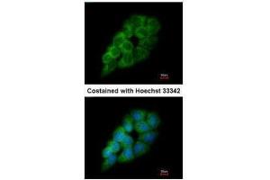 ICC/IF Image Immunofluorescence analysis of methanol-fixed A431, using DARS, antibody at 1:200 dilution. (DARS 抗体)