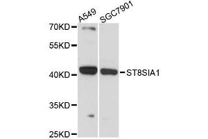 Western blot analysis of extracts of various cell lines, using ST8SIA1 antibody (ABIN5996532) at 1:3000 dilution. (ST8SIA1 抗体)