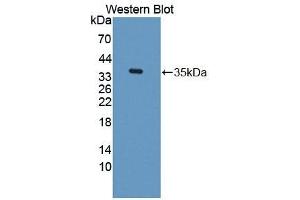 Detection of Recombinant TKT, Rat using Polyclonal Antibody to Transketolase (TKT) (TKT 抗体  (AA 1-286))