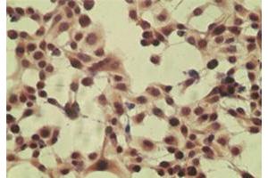 ICC staining of HeLa cell using control (rabbit Ig) at 5 ug/mL . (CYLD 抗体  (AA 32-45))