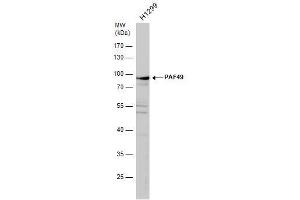 WB Image PAF49 antibody detects PAF49 protein by western blot analysis. (CD3EAP 抗体  (Center))