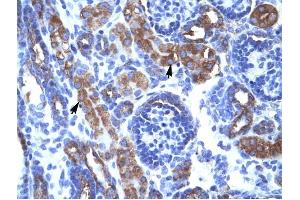 CHEK1 antibody was used for immunohistochemistry at a concentration of 4-8 ug/ml to stain Epithelial cells of renal tubule (arrows) in Human Kidney. (CHEK1 抗体)