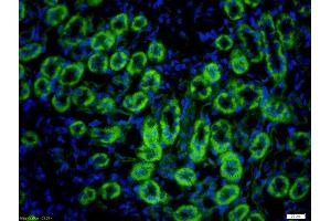 Formalin-fixed and paraffin embedded rat kidney labeled with Rabbit Anti-Hepsin Polyclonal Antibody, Unconjugated (ABIN716816) at 1:200 followed by conjugation to the secondary antibody Goat Anti-Rabbit IgG, FITC conjugated used at 1:200 dilution for 40 minutes at 37°C. (Hepsin 抗体  (AA 311-417))