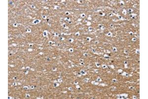 The image on the left is immunohistochemistry of paraffin-embedded Human brain tissue using ABIN7130690(PPP3CA Antibody) at dilution 1/30, on the right is treated with fusion protein. (PPP3CA 抗体)