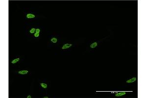 Immunofluorescence of monoclonal antibody to HOXC12 on HeLa cell. (HOXC12 抗体  (AA 1-100))