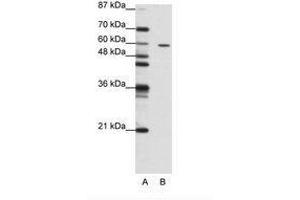 Image no. 1 for anti-Zinc Finger Protein 382 (ZNF382) (N-Term) antibody (ABIN202748) (ZNF382 抗体  (N-Term))