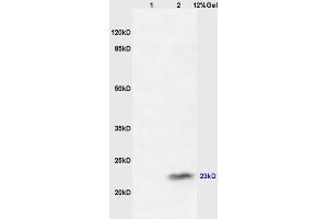 SDS-PAGE (SDS) image for anti-Cancer/testis Antigen 2 (CTAG2) (AA 121-210) antibody (ABIN721135)