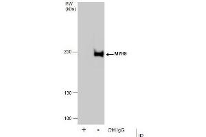 IP Image Immunoprecipitation of MYH9 protein from HeLa whole cell extracts using 5 μg of MYH9 antibody [N1], N-term, Western blot analysis was performed using MYH9 antibody [N1], N-term, EasyBlot anti-Rabbit IgG  was used as a secondary reagent.