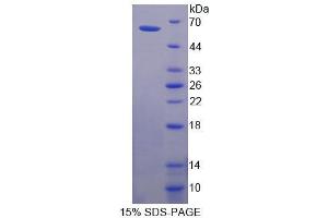 SDS-PAGE analysis of Human CDSN Protein. (Corneodesmosin Protein (CDSN))