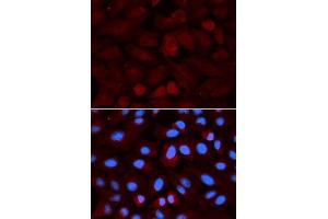 Immunofluorescence analysis of U2OS cells using ALDH3A1 antibody. (ALDH3A1 抗体  (AA 1-300))