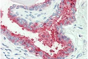 Anti-SLC12A2 / NKCC1 antibody  ABIN960804 IHC staining of human prostate. (SLC12A2 抗体  (Internal Region))