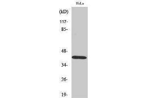 Western Blotting (WB) image for anti-serpin Peptidase Inhibitor, Clade B (Ovalbumin), Member 5 (SERPINB5) (Internal Region) antibody (ABIN3180164) (SERPINB5 抗体  (Internal Region))
