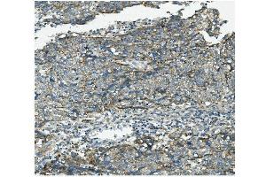 IHC analysis of VPS4B/MIG1 using anti-VPS4B/MIG1 antibody (ABIN7599560).