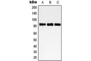 Western blot analysis of NCAPH expression in HeLa (A), Jurkat (B), MOLT4 (C) whole cell lysates. (NCAPH 抗体  (Center))