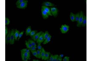 Immunofluorescence staining of HepG2 cells with ABIN7159453 at 1:100, counter-stained with DAPI. (Cyclin M2 抗体  (AA 739-875))