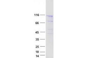 Western Blotting (WB) image for SEC24 Family, Member C (SEC24C) (Transcript Variant 2) protein (Myc-DYKDDDDK Tag) (ABIN2731575)