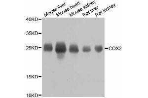 Western blot analysis of extracts of various cell lines, using MT-CO2 antibody. (COX2 抗体)