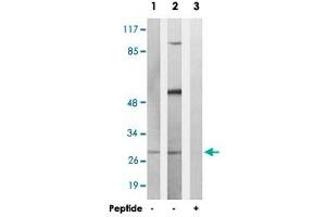 Western blot analysis of extracts from K-562 cells and COS-7 cells, using MARCH3 polyclonal antibody . (MARCH3 抗体)
