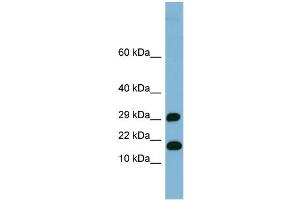 WB Suggested Anti-TRAPPC2L Antibody Titration: 0. (TRAPPC2L 抗体  (N-Term))