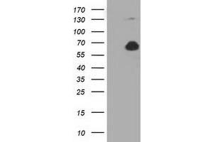 Western Blotting (WB) image for anti-Pyruvate Kinase, Liver and RBC (PKLR) antibody (ABIN1500246) (PKLR 抗体)