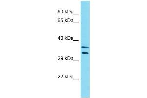 Western Blotting (WB) image for anti-Leiomodin 3 (LMOD3) (N-Term) antibody (ABIN2774556) (LMOD3 抗体  (N-Term))