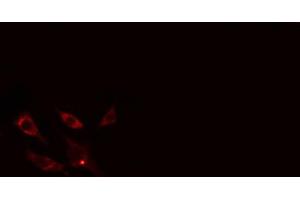 Immunofluorescence (fixed cells) (IF/ICC) image for anti-Collagen, Type XIII, alpha 1 (COL13A1) (C-Term) antibody (ABIN6260954)