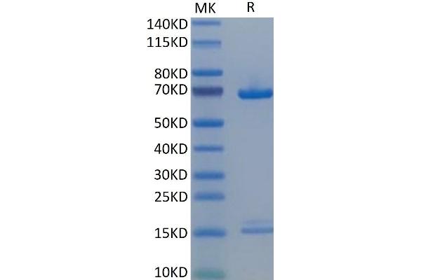 PCSK9 Protein (AA 31-692) (His tag)