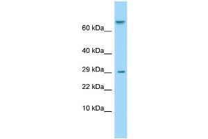 Host: Rabbit Target Name: TAS1R1 Sample Type: ACHN Whole Cell lysates Antibody Dilution: 1. (TAS1R1 抗体  (Middle Region))