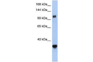 WB Suggested Anti-XPO5 Antibody Titration:  0. (XPO5 抗体  (Middle Region))