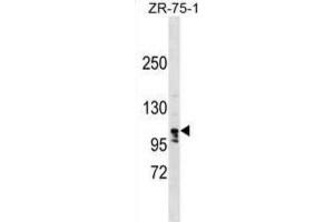 Western Blotting (WB) image for anti-La Ribonucleoprotein Domain Family, Member 1B (LARP1B) antibody (ABIN2999647) (LARP1B 抗体)