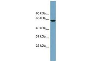 Image no. 1 for anti-Solute Carrier Family 5 (Iodide Transporter), Member 8 (SLC5A8) (AA 431-480) antibody (ABIN6743239)