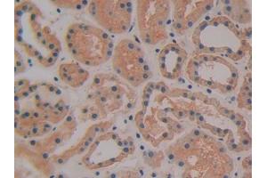 DAB staining on IHC-P; Samples: Human Kidney Tissue (TFPI 抗体  (AA 29-304))