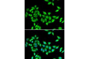 Immunofluorescence analysis of U20S cell using KIF3A antibody. (KIF3A 抗体)