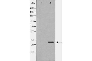 Western blot analysis of lung1  lysate using FGF10 antibody. (FGF10 抗体  (C-Term))