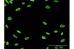 Immunofluorescence of purified MaxPab antibody to PARP1 on HeLa cell.