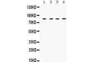 Western Blotting (WB) image for anti-Transforming Growth Factor, beta Receptor II (70/80kDa) (TGFBR2) (AA 96-128), (N-Term) antibody (ABIN3043311) (TGFBR2 抗体  (N-Term))