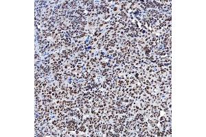 IHC analysis of SF3A1 using anti-SF3A1 antibody (ABIN7600556). (SF3A1 抗体  (AA 20-556))