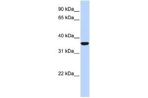 WB Suggested Anti-MAFB Antibody Titration: 0. (MAFB 抗体  (N-Term))