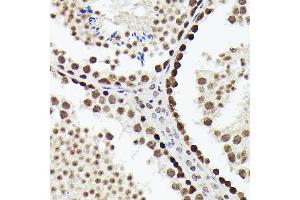 Immunohistochemistry of paraffin-embedded mouse testis using SOX4 antibody (ABIN7270575) at dilution of 1:150 (40x lens). (SOX4 抗体  (AA 1-100))
