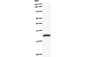 Western Blotting (WB) image for anti-Activating Transcription Factor 3 (ATF3) antibody (ABIN5676162) (ATF3 抗体)