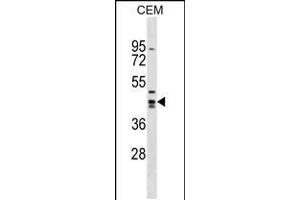 Western blot analysis in CEM cell line lysates (35ug/lane). (Zinc Finger and SCAN Domain Containing 9 (ZSCAN9) (AA 217-243) 抗体)